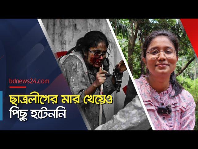 ছাত্রলীগের হামলার শিকার তন্বি কেমন আছেন? | DU Student | @bdnews24