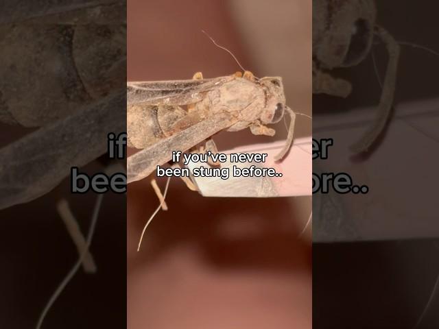 the bug sting theory is REAL 