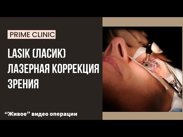 LASIK (ЛАСИК) - живое видео операции лазерной коррекции зрения в Prime Clinic (Москва)