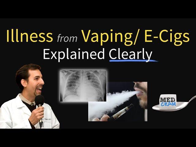 Vaping / E-Cigarette Lung Failure, Illness, Disease Outbreak