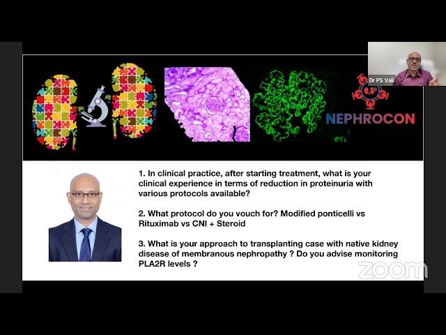 Nephrocon x MEMBRANOUS NEPHROPATHY