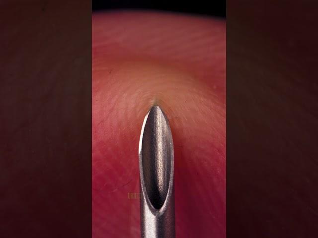 Fingerprint and Needle