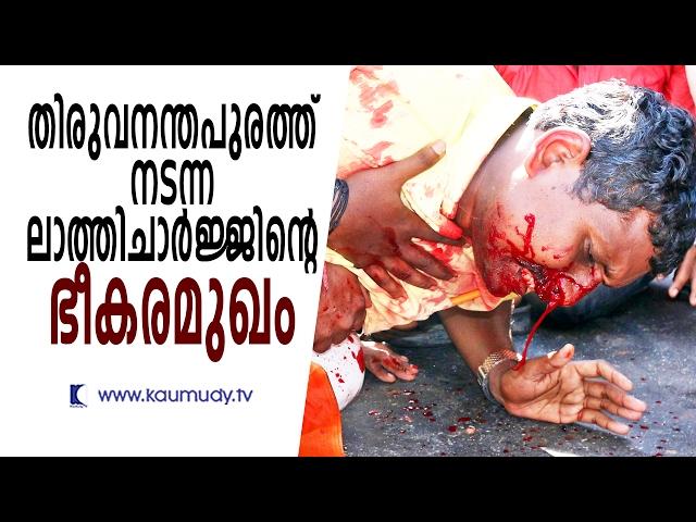 BJP Road Dharna turns Nasty | News in Pictures | Keralakaumudi