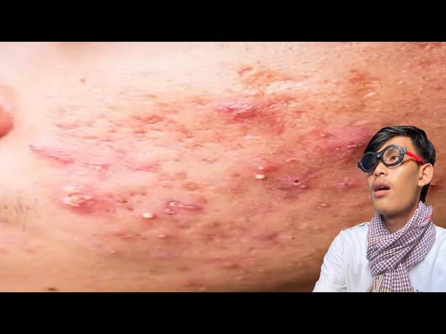 omg relaxing skincare routine #bea3 #youtubeshorts #yt #7777