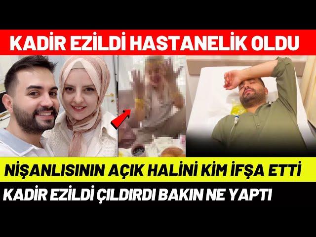 Kadir Ezildi'nin Nişanlısının Açık Hali İfşa Oldu Kadir Ezildi Hastanelik Oldu