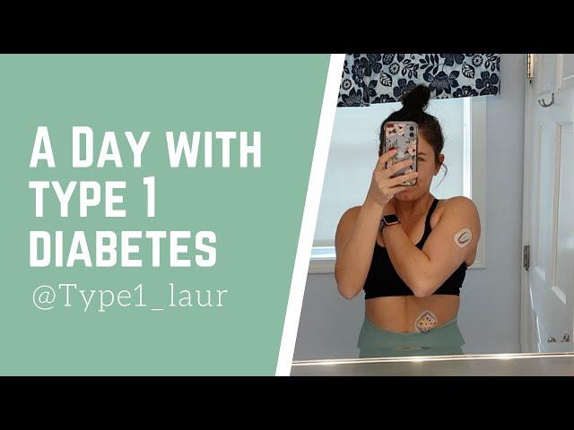 VLOG: A day in the life with Type 1 Diabetes!