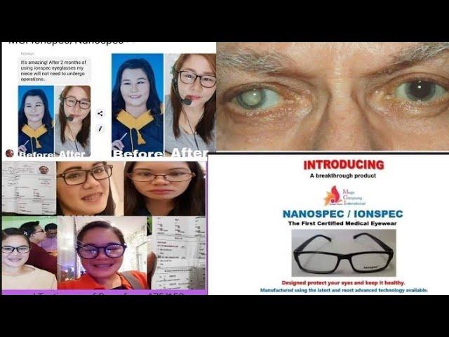 Ionspec Medical Eyewear Presentation|viral