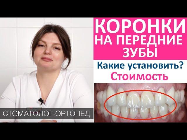 Зубные коронки на передние зубы: какие установить? Виды коронок для зубов, материалы, цена, гарантия