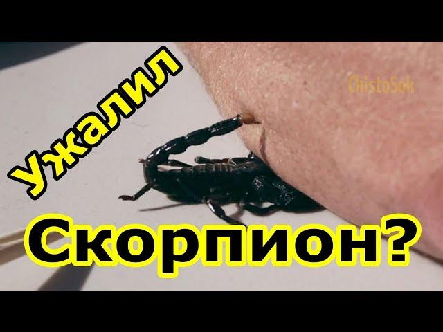 Ужалил скорпион, что делать? Как избежать встречи со скорпионом?