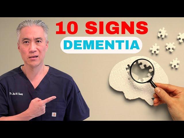 Memory PROBLEMS-TOP 10 SIGNS