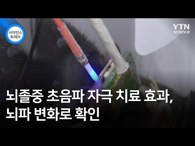 뇌졸중 초음파 자극 치료 효과, 뇌파 변화로 확인 / YTN 사이언스