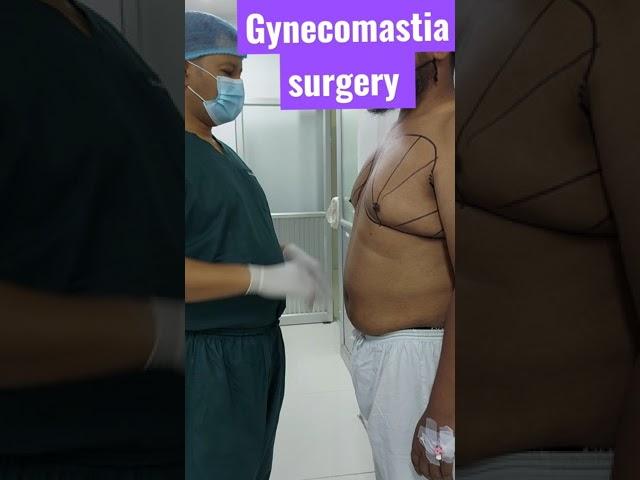 Gynecomastia surgery Bangladesh | Male breast reduction | Dr Iqbal Ahmed plastic surgery