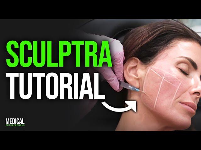 How to Inject Sculptra for Facial Volume Loss & Glowy Skin | Full Procedure Demonstration