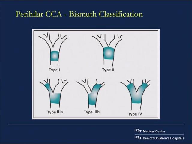 2018 Cholangiocarcinoma Foundation Annual Conference #8 - Day 1 - Management of Biliary Obstruction