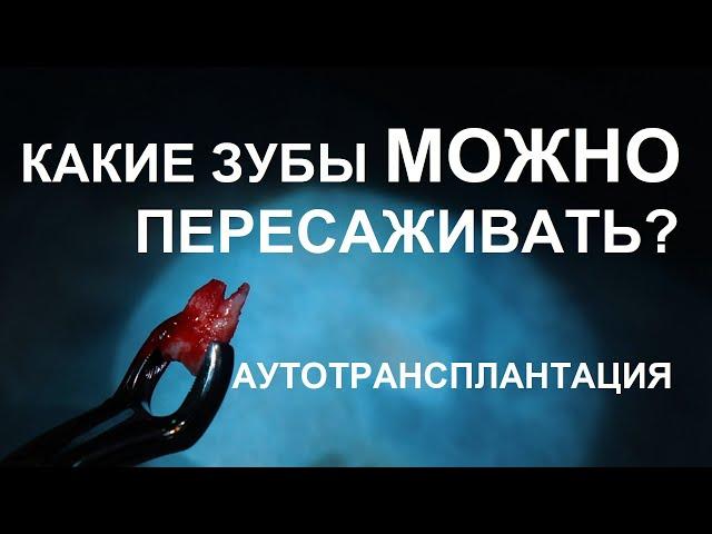 Какой зуб можно пересадить при аутотрансплантации? - Немецкий имплантологический центр, Москва