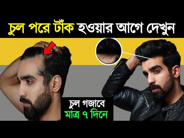 চুল পড়া বন্ধ ও নতুন চুল গজানোর উপায় | How To Grow Hair and Stop Hair Fall | Success Never End