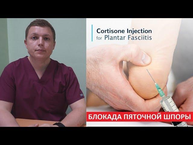 Блокада пяточной шпоры | Plantar Fasciitis Injection Treatment