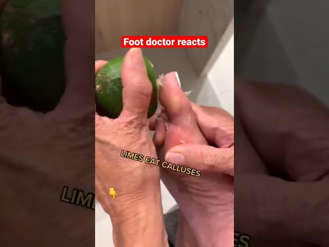 Doctor reacts: foot callus lifehack