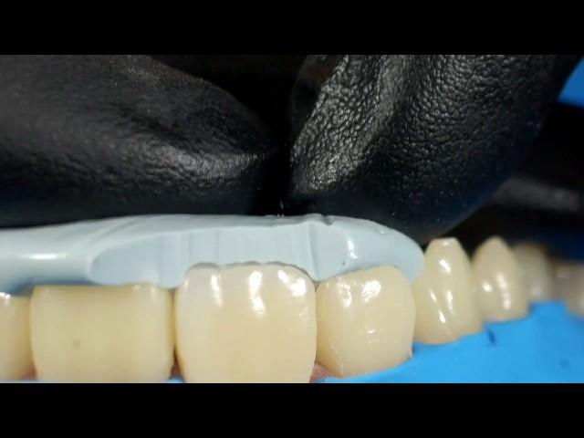 DentalПлюшки 24 - силиконовый ключ