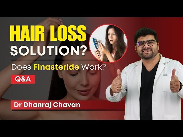 क्या Finasteride से Hair Fall रुक जायेंगे?  | Finasteride for Hair Loss: What to Expect! | HairMD