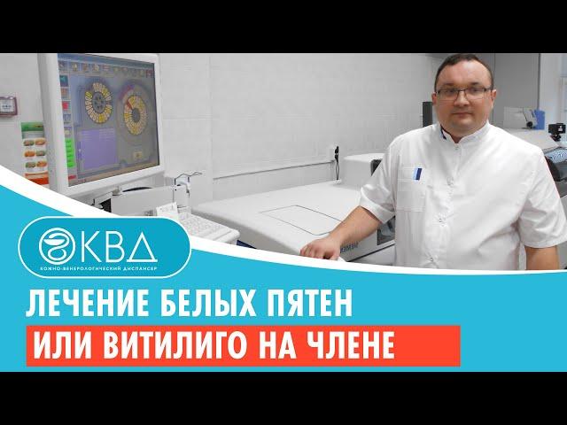  Лечение белых пятен или витилиго на члене. Клинический случай №806