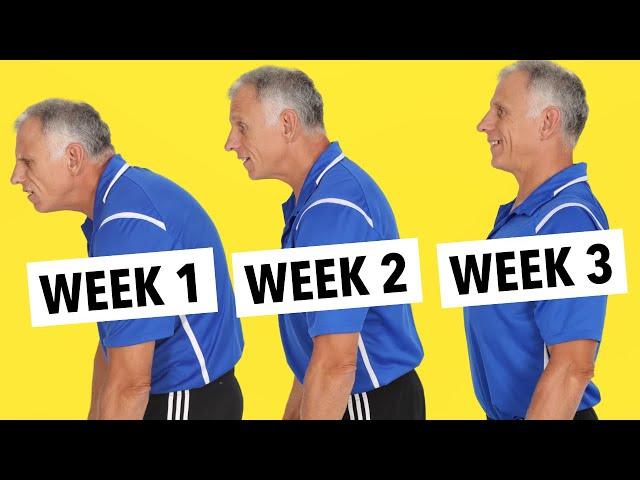 How To Stop Walking Hunched Over! 5 Best Fixes