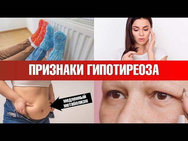 Ранние симптомы гипотиреоза. Диагностика гипотиреоза