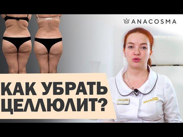 ⭐️ КАК ИЗБАВИТЬСЯ ОТ ЦЕЛЛЮЛИТА на попе и ногах? ⭐️ В домашних условиях⭐️Процедуры от целлюлита