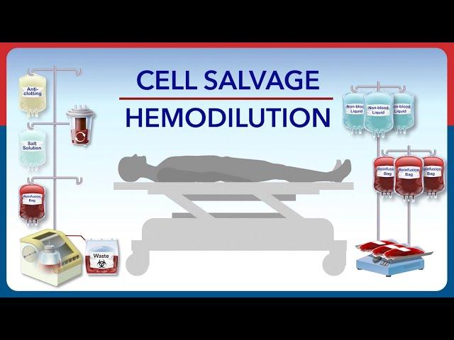 Cell Salvage and Hemodilution