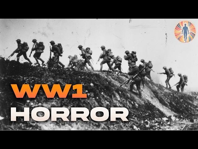 5 Unsettling Stories From The Trenches Of World War I