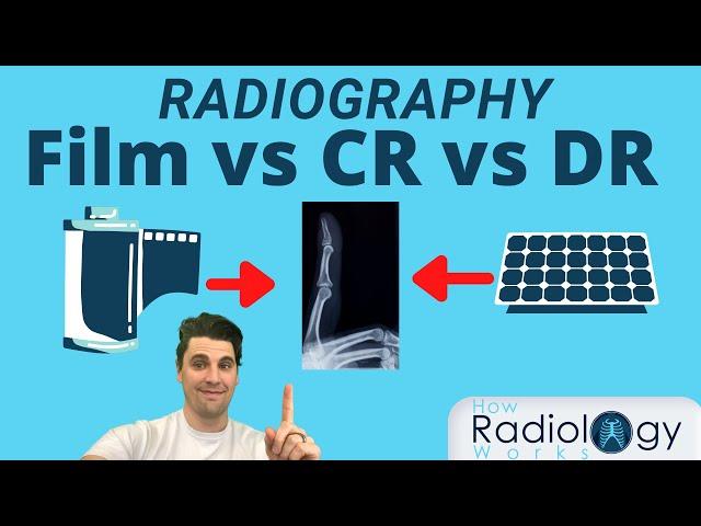 Film vs CR vs DR (for Radiologic Technologists)