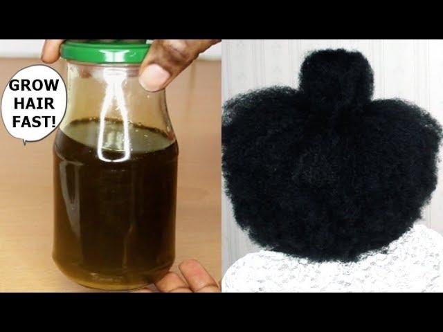 YOUR HAIR WILL GROW LIKE CRAZY IF YOU USE THIS OIL - GROW HAIR Long, Thick & Healthy FAST!