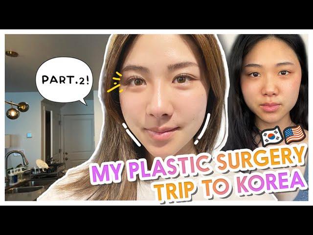 MY PLASTIC SURGERY TRIP TO KOREA Part 2 (Facial contour, Rhinoplasty & Double eyelid surgery)