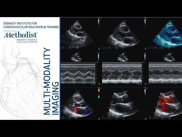 Multi-Modality Miscellaneous Case Studies (Parikh, MD, Khalaf, MD, Narezkin, MD) May 14, 2019