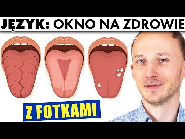 Wyczytaj choroby i niedobory z wyglądu swojego języka! Zmiany na języku | Dr Bartek Kulczyński