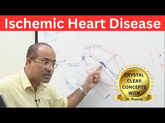 Ischemic Heart Disease | Myocardial Infarction | Cardiology🫀