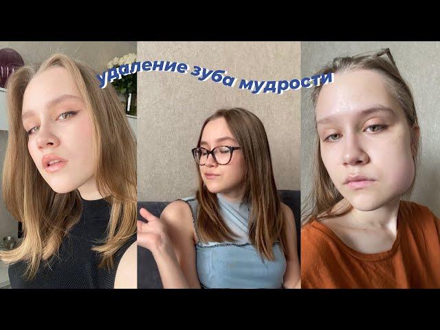 удаление зуба мудрости // мой опыт