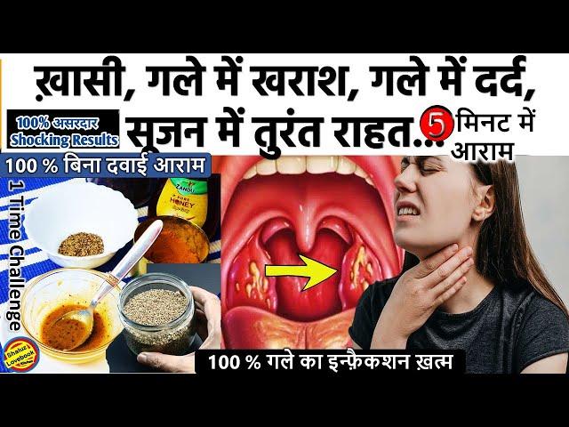 गले में सूजन, ख़ासी, ख़राश, Infection तुरंत ठीक करने के 2 रामबाण तरीके- Throat Infection home remedies