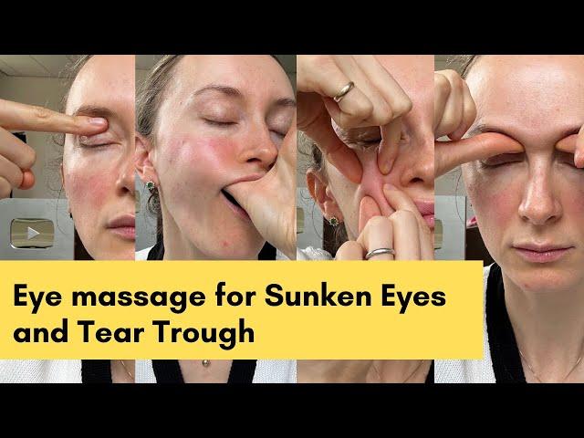 Eye massage for Sunken Eyes and Tear Trough