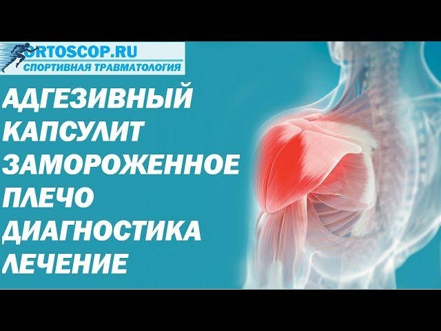 АДГЕЗИВНЫЙ КАПСУЛИТ.ЗАМОРОЖЕННОЕ ПЛЕЧО.FROZEN SHOULDER