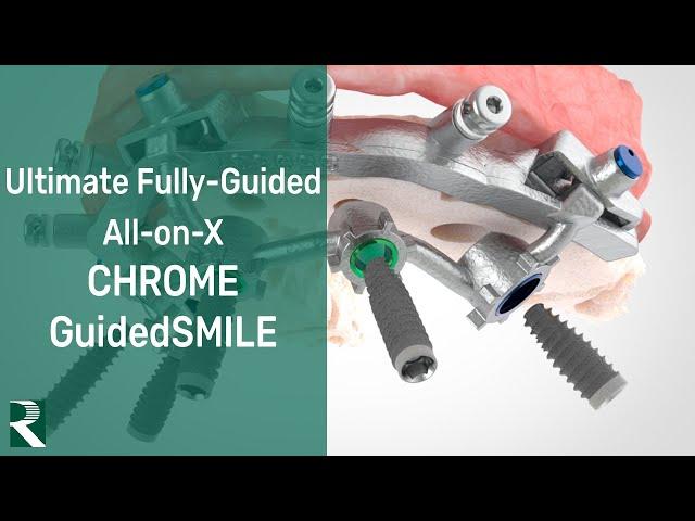 Ultimate Fully-Guided All-on-X: CHROME GuidedSMILE Full Arch