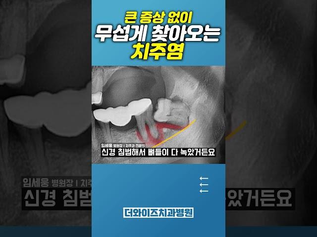 치주염 방치하면 신경까지 손상된다고? #임플란트 #치과의사 #dentist