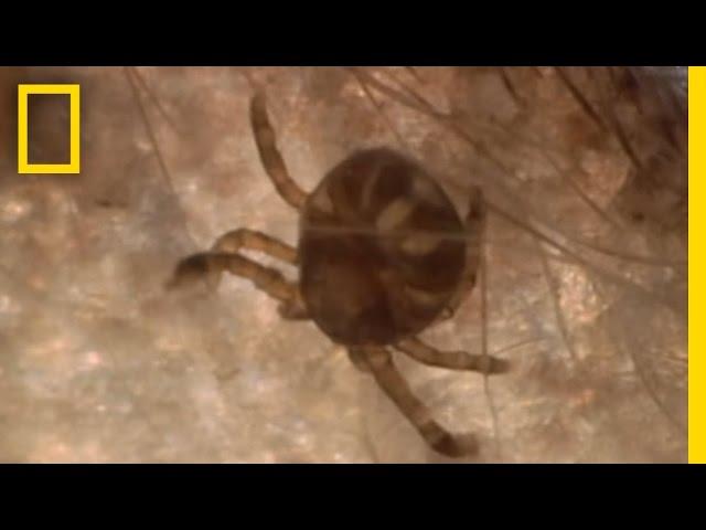 Dangerous Deer Ticks | National Geographic