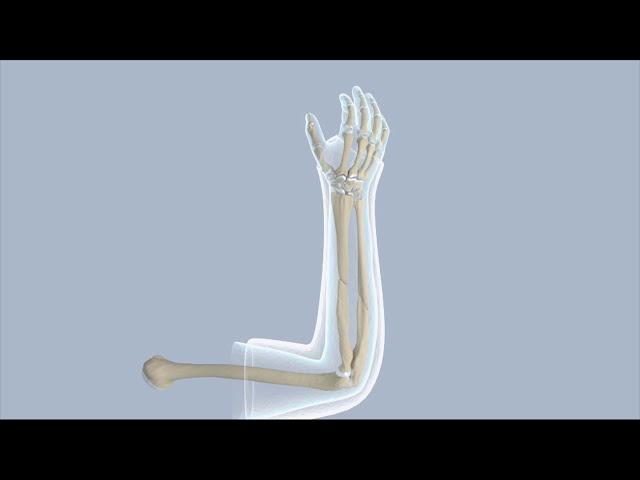 Closed Reduction of a Forearm Fracture