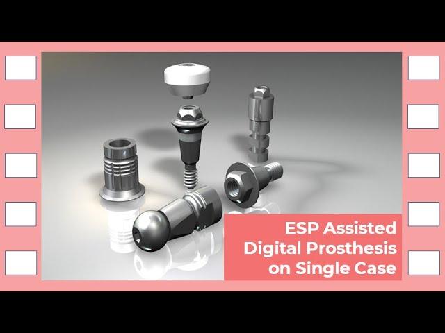 [warantec] ESP Assisted Digital Prosthesis on Single Case