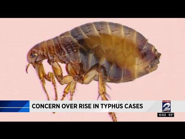 Concern over rise in typhus cases