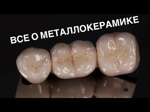 Металлокерамика. Главные минусы. Что такое гирлянда и плечевая масса?