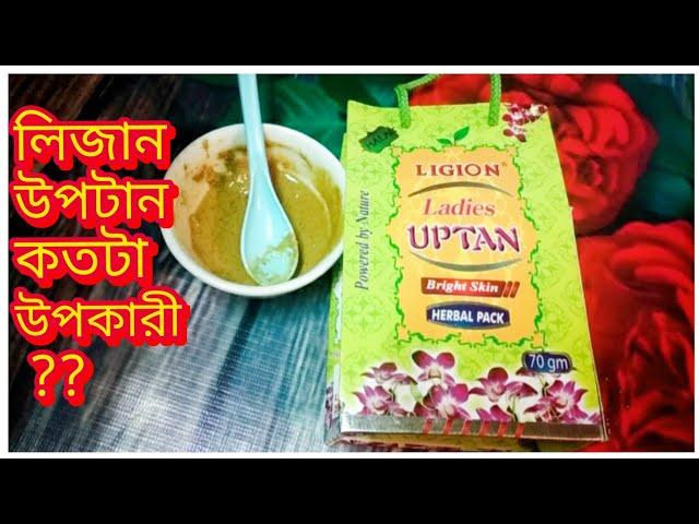 লিজান উপটান এর উপকারিতা কি | ত্বক ফর্সা হওয়ার জন্য কতোটা  কার্যকারি জানতে দেখুন |lizan ubtan review