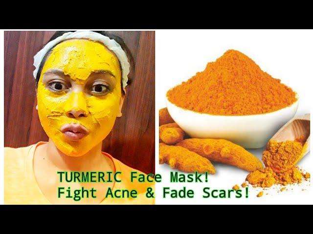 HOME REMEDIES TURMERIC FACE MASK/ BEST ACNE TREATMENT/ GET CLEAR, BRIGHT AND ACNE FREE IN 7 DAYS!