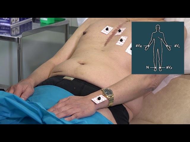 Recording a 12 lead ECG